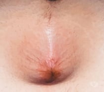 Pour actif chaud