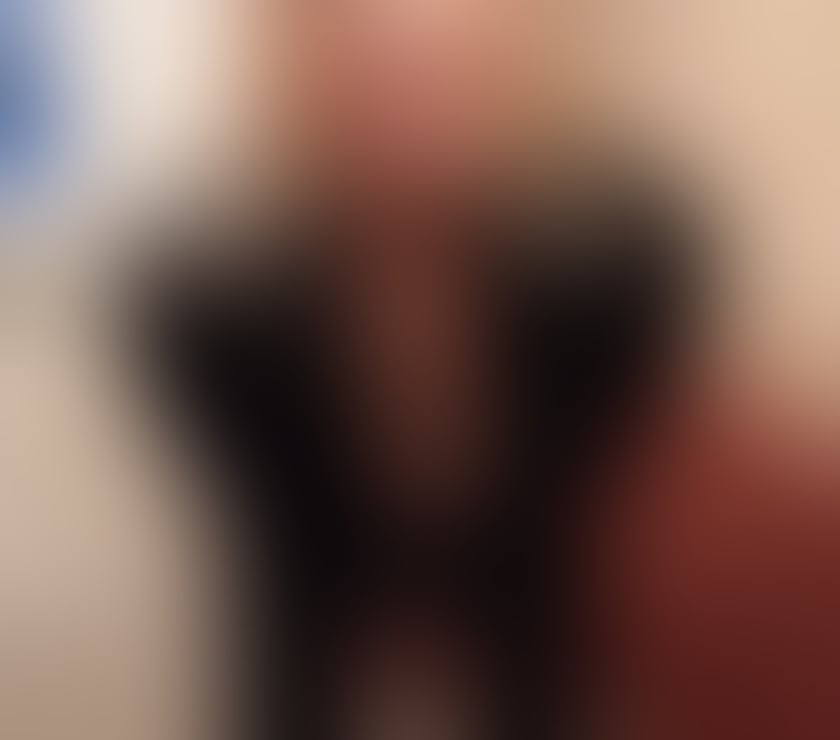 Escorts Kent Dartford - Photos for TS ANNIE - Post Op