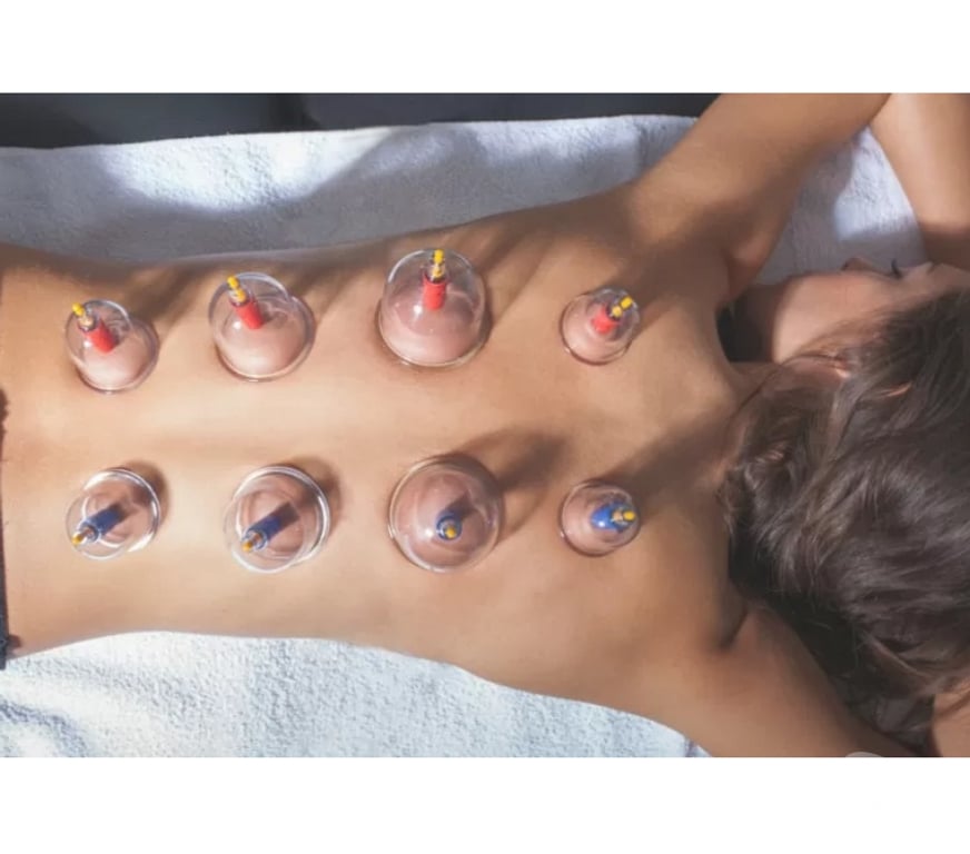 Full body massage Bedfordshire Luton - Photos for Mobile Ladies only Cupping Massage Therapy Outcall