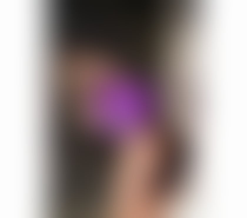 Escorts Waltham Cross Broxbourne - Photos for YOLI🔥 GOOD SERVICE BRAZILIAN SWEET