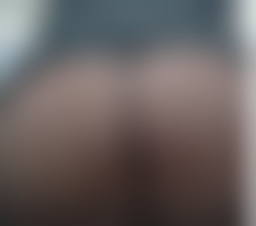 Escorts West Midlands Birmingham - Photos for LUNA SEXY post op TS 07377 097607