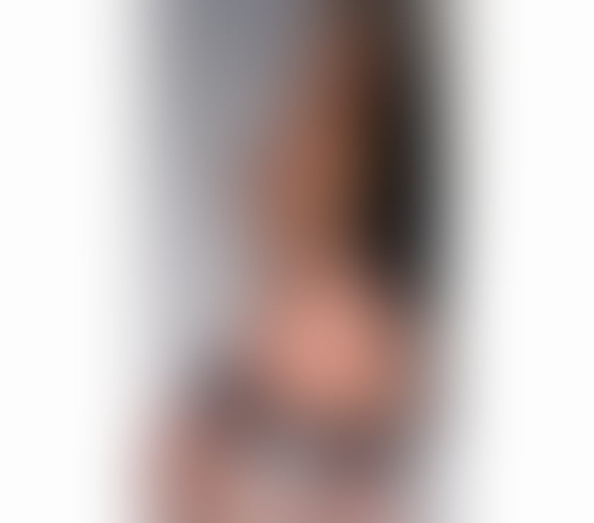 Escorts Kent Maidstone - Photos for 💯🍌🍑no rush💯fresh💯genuine🍌🍑