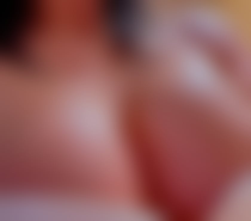Escorts Norfolk King's Lynn and West Norfolk - Photos for CherryBombEastAnglia is back!🍒