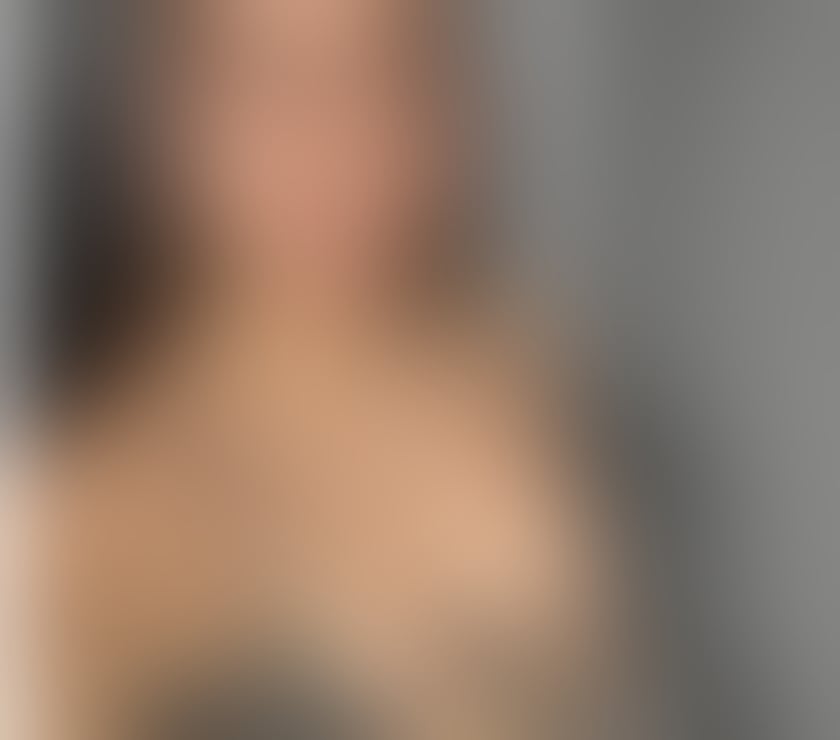 Escorts West Midlands Birmingham - Photos for 🔥🇧🇷 CHLOE PARTY GIRL🔥GFE