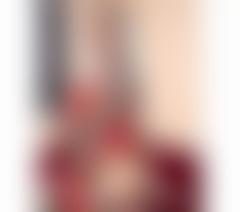Escorts East London Stratford - East London - Photos for 🪭New hot brazilian blonde 🪭Real 💯Party girl 🔝