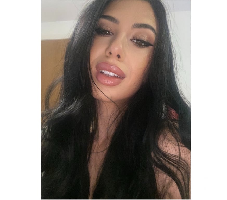 Escorts West Midlands Birmingham - Photos for 〰️❌ THE BEST SERVICES ✨ BACK IN TOWN ✨