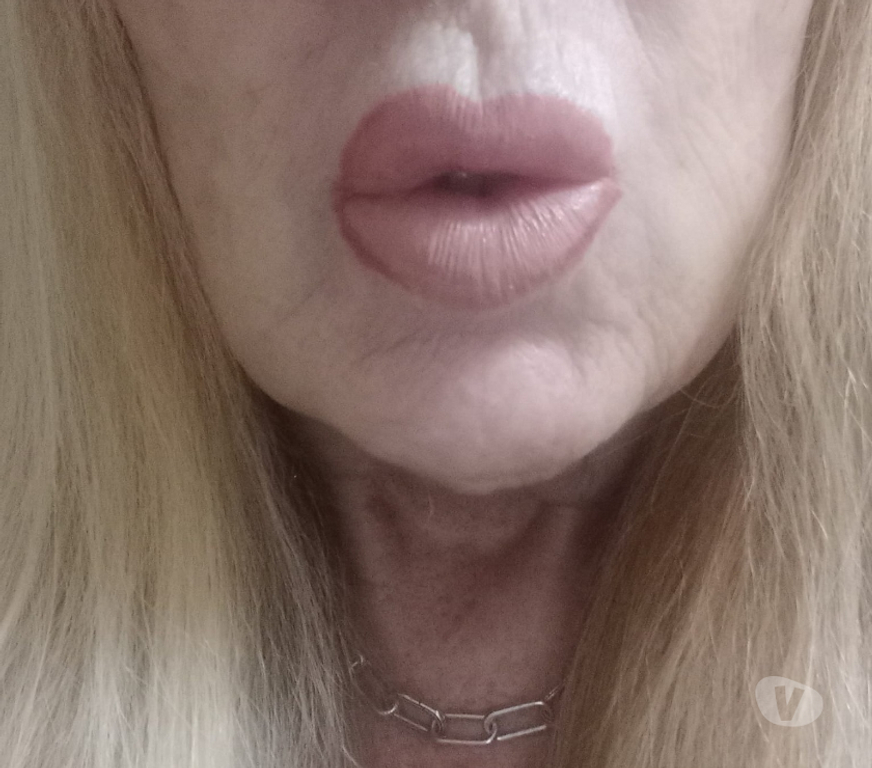 Adult Entertainment East Sussex Brighton - Photos for Nurse Trixie looking for phone interaction