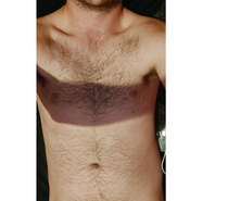 Hung Vers Lad Available Now