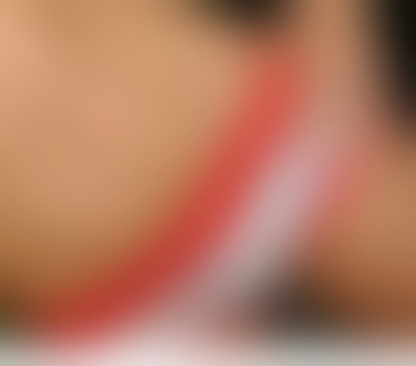 Escorts Bedfordshire Luton - Photos for ❤️ JUST OUTCAL❤️ NEW GIRL ON LUTON❤️