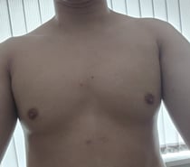 Deep tissue massage