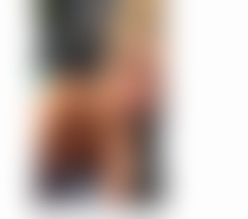 Escorts Kent Medway - Kent - Photos for ANA PARTY GIRL ♥️ LEVEL A 🔥 NO RUSH X