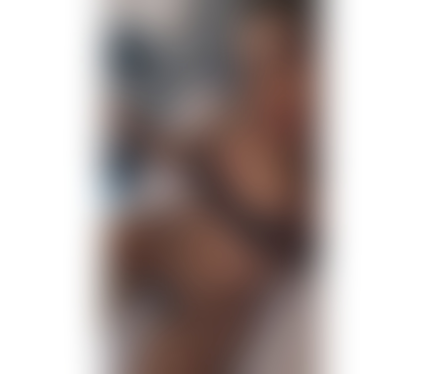 Escorts Dartford Town Centre Dartford - Photos for EDUARDA💥EBONY 🧿EXCLUSIVE IN DARTFORD