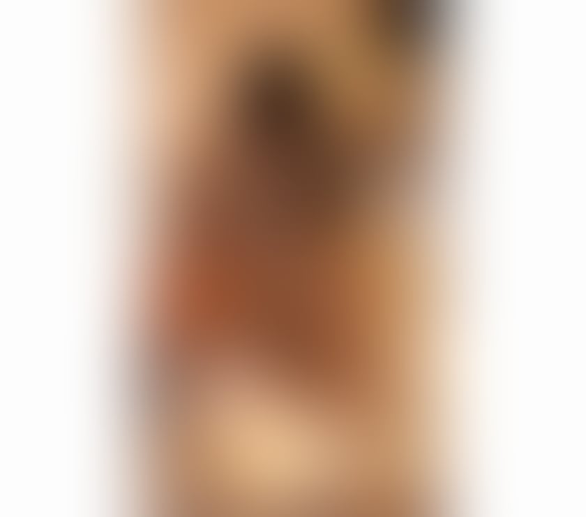Escorts Essex Brentwood - Photos for 🔥MEL PERFECT GIRL BODY🍭PARTY ❤️🔥🇧🇷