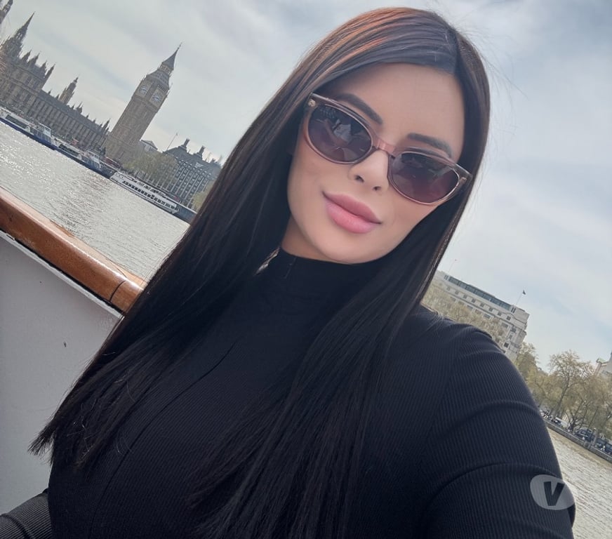 Escorts Somerset Bath and North East Somerset - Photos for Susan Brazilian Girl Party 🥵🫦