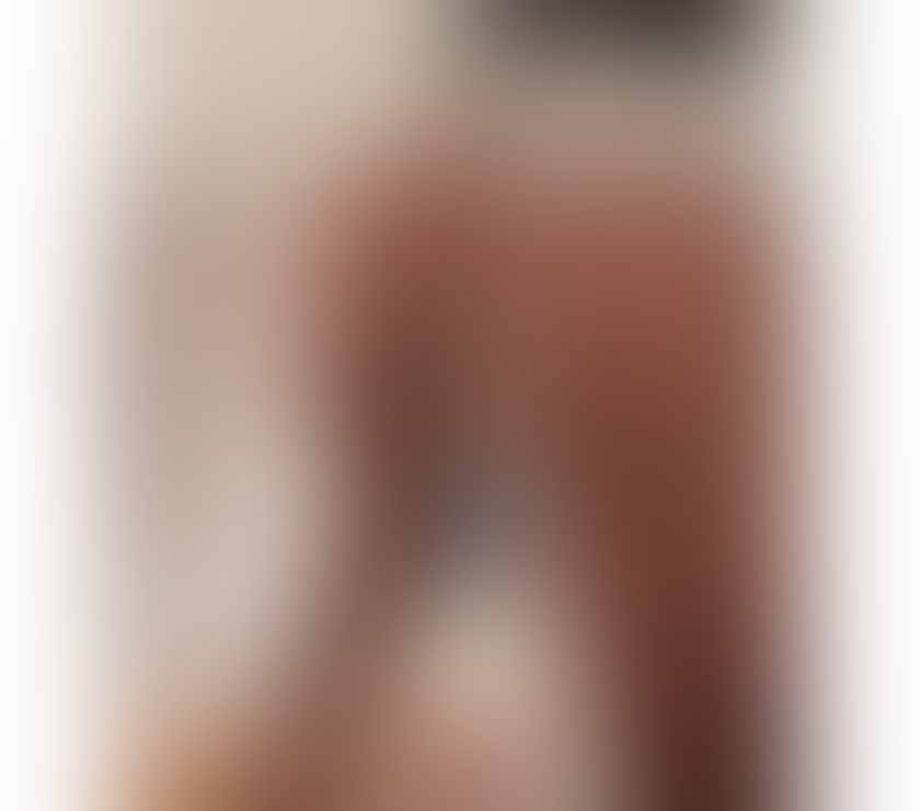 Escorts East London Forest Gate - East London - Photos for MELYSA💋YOUNG & BEAUTIFUL- NEW IN TOWN 💋 CALL ME