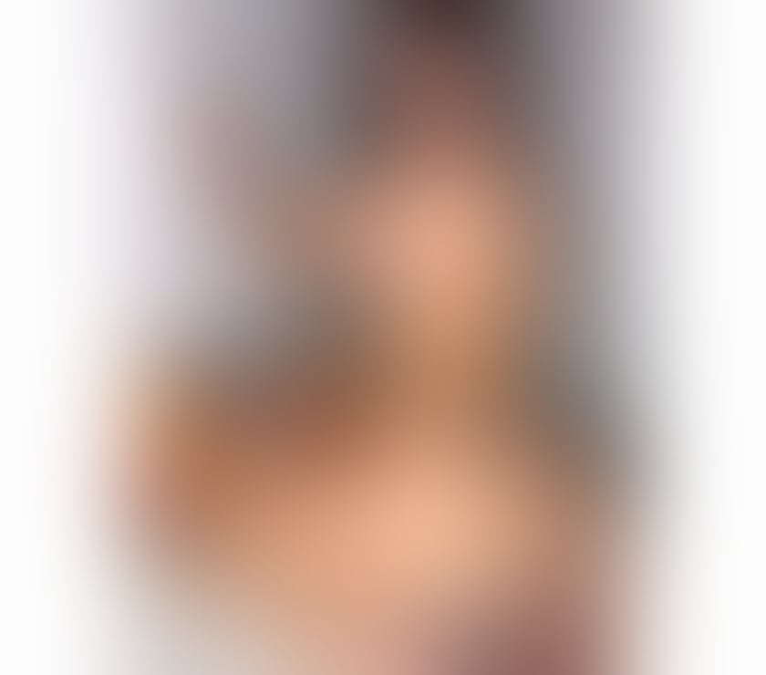 Escorts Bristol Barton Hill - Bristol - Photos for 🥳Reall escort just arrived only few days ❤️