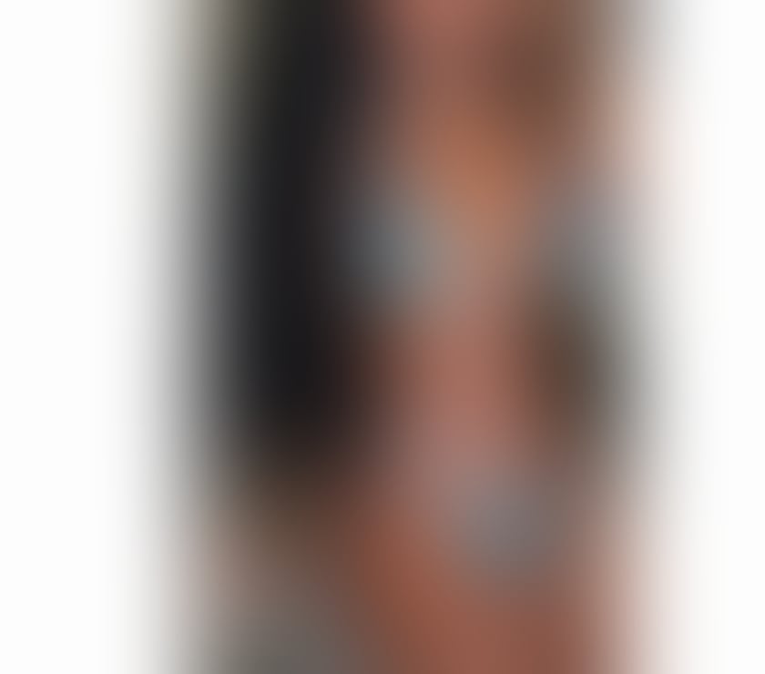 Escorts Bridgtown Cannock Chase - Photos for NEW IN TOWN PARTY 💯XFULL SERVICES ❤️