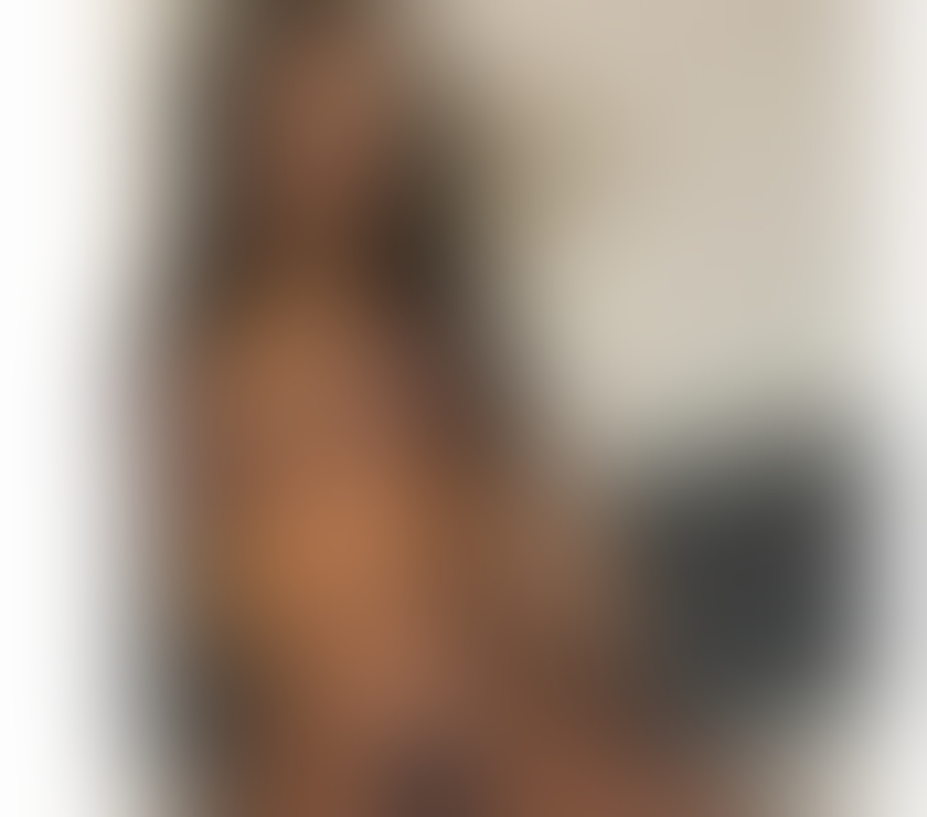 Escorts Kent Tonbridge and Malling - Photos for NEW IN TOWN MEDEEA ,❣️OUTCALL ONLY