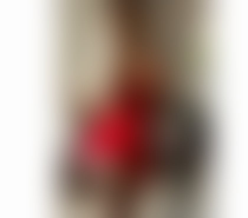 Escorts Kent Medway - Kent - Photos for 💦PARTY🥳YOUNG🔞VERY NAUGHTY💦