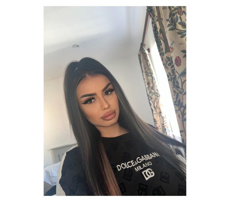 Escorts Hertfordshire Dacorum - Photos for Chelsea🔝 high class🔞🎉💯REAL🔝no rush
