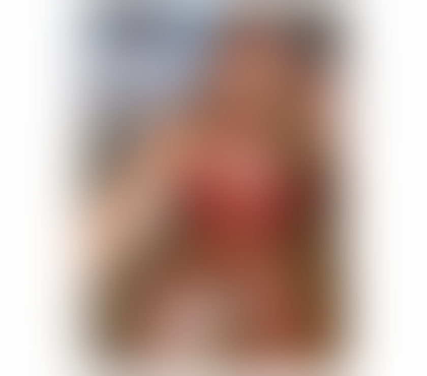 Escorts Somerset North Somerset - Photos for Alise✅ Real Lady 100% top class escort in you're Town ✅