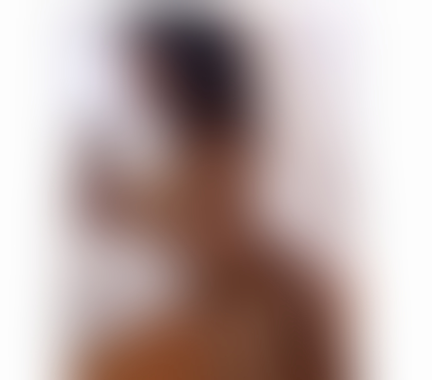 Escorts East Ayrshire Kilmarnock - East Ayrshire - Photos for BRUNA 🔥 YOUR BEST COMPANY 🔥