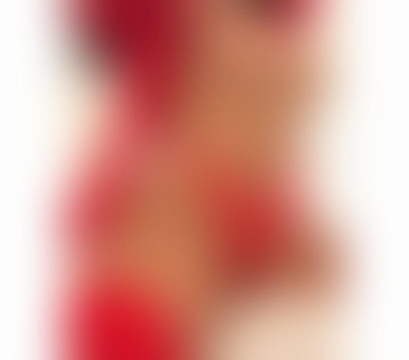 Escorts South East London Peckham - South East London - Photos for 🌟TOP🌟💯GOOD SERVICES🍒MICHELLE🌹