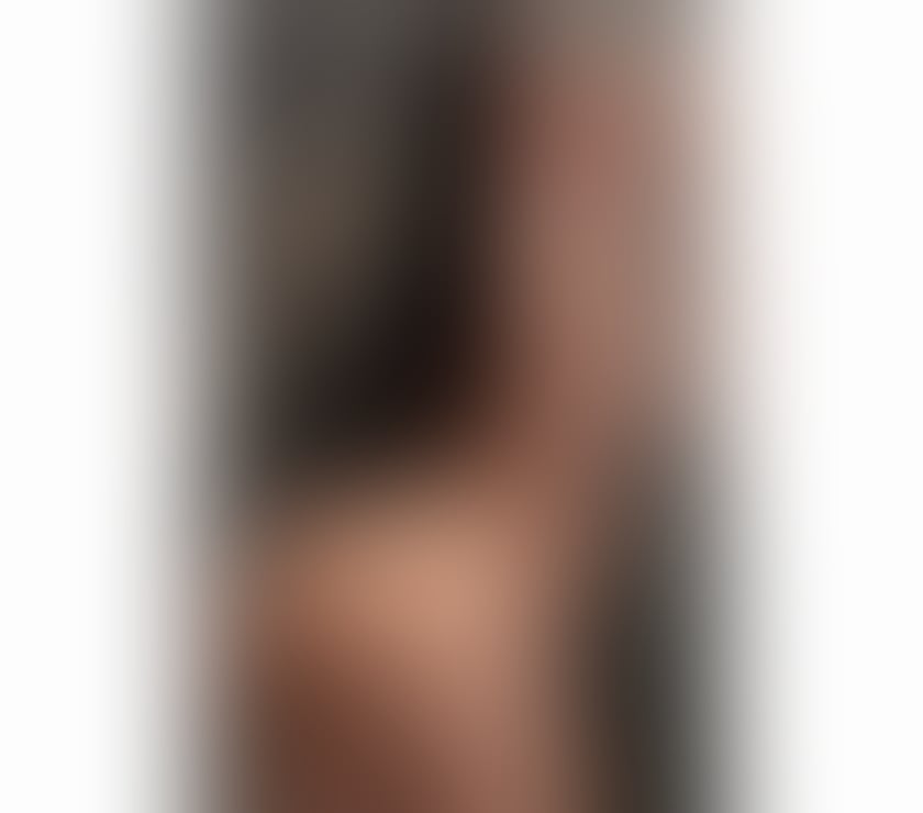 Escorts East London Hackney - East London - Photos for 🔥 Sexy girl 🇧🇷 Nice body 🍑