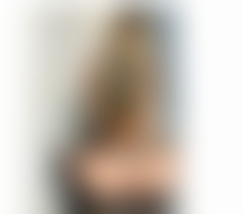 Escorts Norfolk Norwich - Photos for 🍒Naughty Lara 🪩 🔝HOTTEST BLONDE 🔝SLIM🔞Party