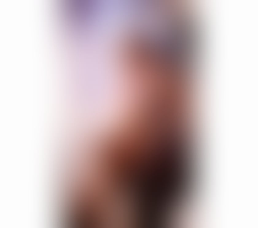 Escorts South East London Croydon - Photos for First Time in UK | One Leg Girl | Only Today In Croydon