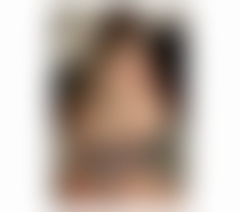 Escorts Bristol Bristol City Centre - Bristol - Photos for BLONDE ✨SLIM BODY LIKE MODEL BRAZILIAN NATURAL✨