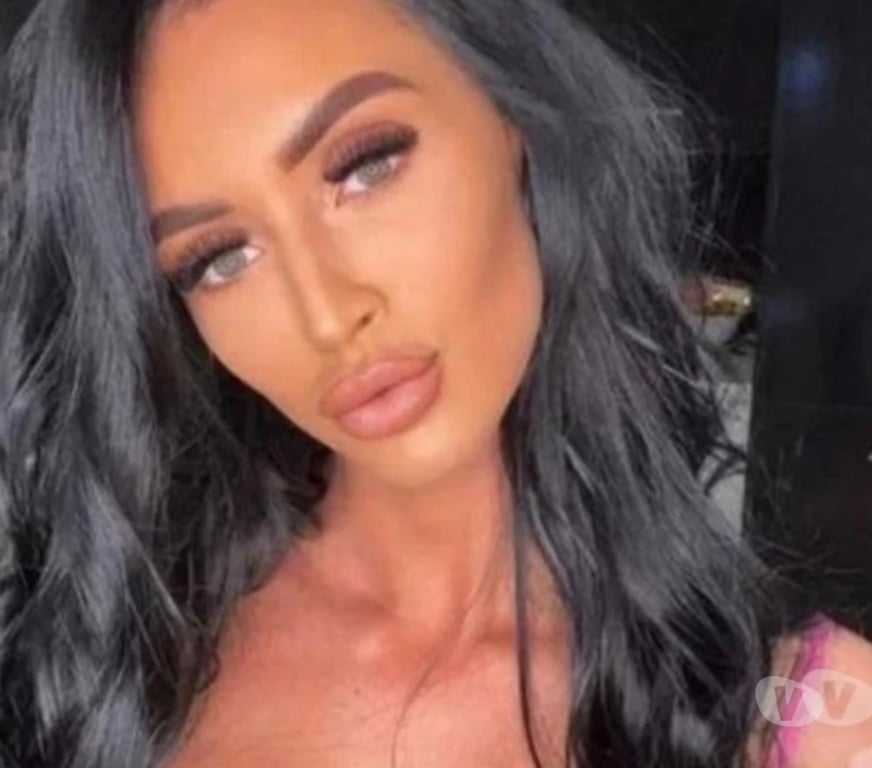 Escorts Hertfordshire St. Albans - Photos for Christine✨Best services🙌🏻NoRush🥳RealPics💯Party