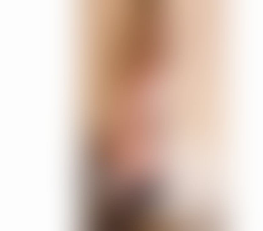 Escorts South East London Bromley - Photos for 💋YOUNG & BEAUTIFUL- NEW IN TOWN 💋 CALL ME