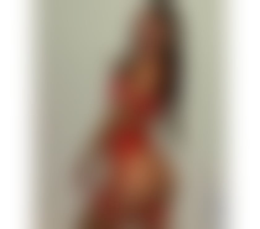 Escorts Dundee Dundee City Centre - Dundee - Photos for BEST SERVICE IN TOWN🔥🔥🔥