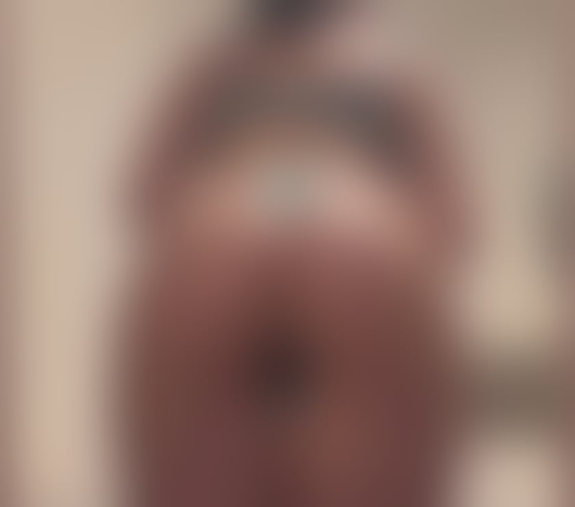 Escorts South East London Croydon - Photos for AMANDA 🔥🔥🍭BRAZILIAN 🔞🔝 OUTCALL