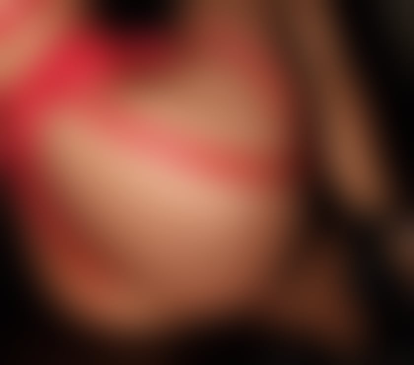 Escorts West Midlands Solihull - Photos for Hi im Roxy new party girl in town 24 7 👅outcall