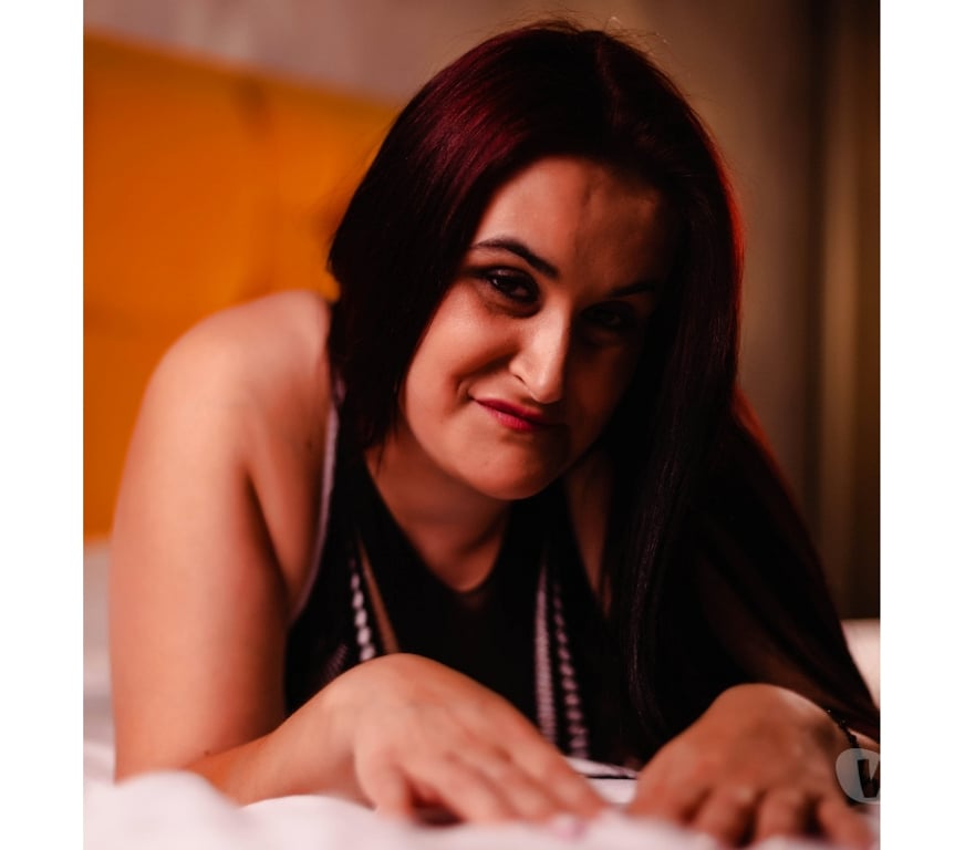 Escorts Bristol Bristol City Centre - Bristol - Photos for 💎 Classy Touring UNIQUE Companion | One-Legged 💎