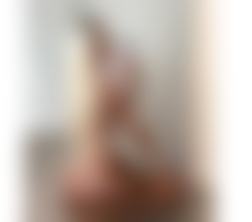 Escorts Kent Canterbury - Photos for NEW IN TOWN 🔥🔥 NO RUSH SERVICE