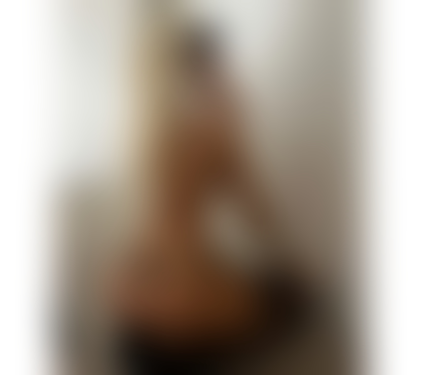 Escorts Kent Canterbury - Photos for NEW IN TOWN 🔥🔥 NO RUSH SERVICE