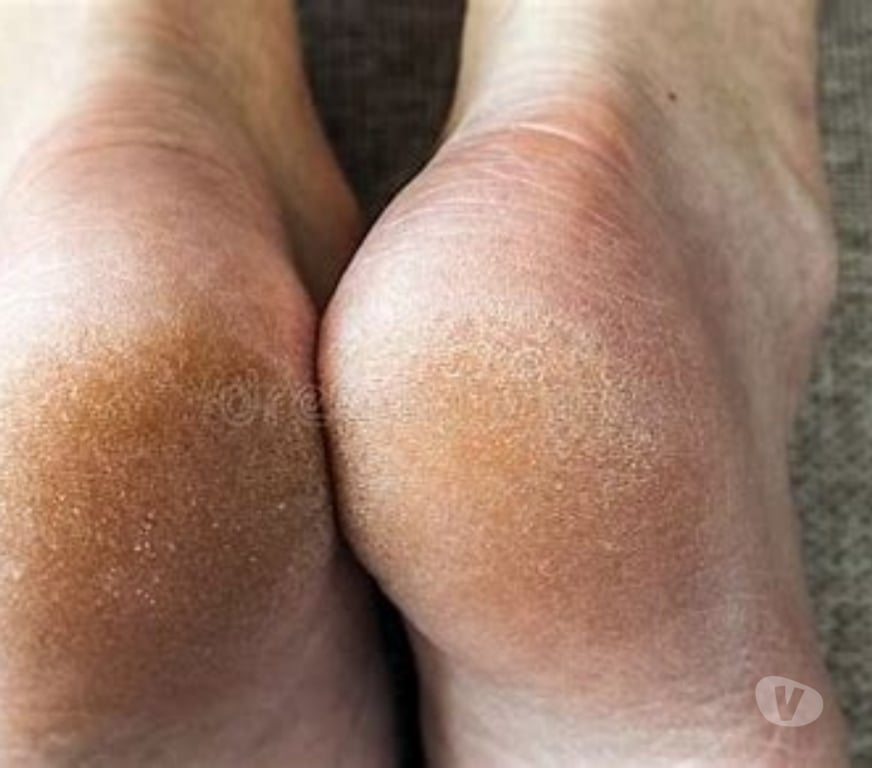Full body massage Essex Southend-on-Sea - Photos for ESSEX SS0 NON SMOKERS ONLY FOOT PEDICURES BODY SCRUBS