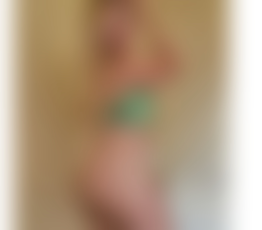 Escorts Bramling Canterbury - Photos for Hi l new city Bety party nice service no rush 🎉🍫