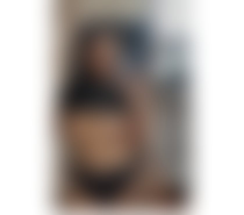 Escorts Staffordshire Stoke-on-Trent - Photos for 💋BONNIE BACK IN STOKE FOR 10 DASY NO LOST YOUR TIME 💋
