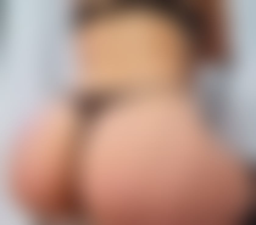 Escorts Kent Gravesham - Photos for 💋Kim X Just Arrived X For few days 💦💯