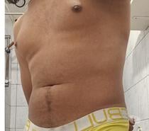 Moreno top fixe