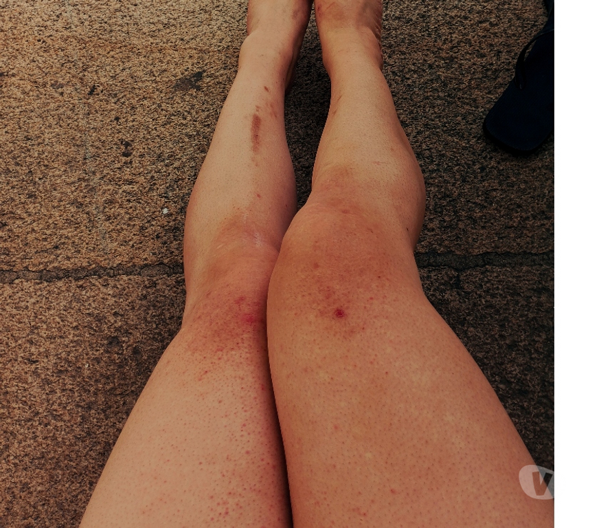 Massagem Maia - Fotos para ScarletCanary Domada pelo VĂcio